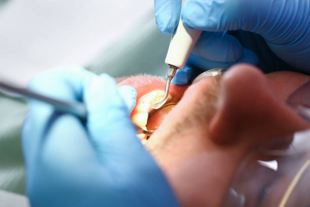 Best Emergency Treatment for Oral Infections in Le Grand, CA
